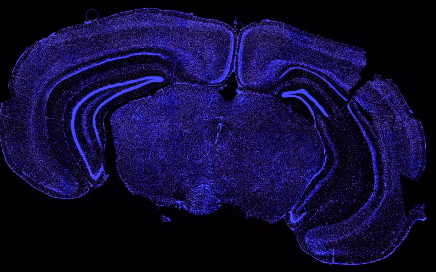 A purple fluorescent mouse brain section reveals densely packed cell nuclei.