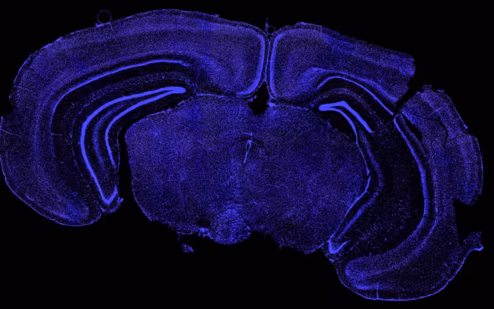 A purple fluorescent mouse brain section reveals densely packed cell nuclei.